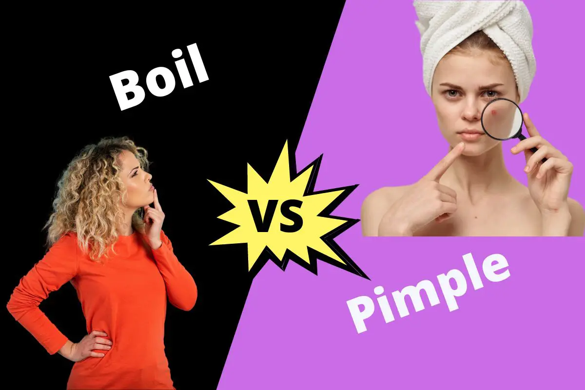 Boil vs Pimple